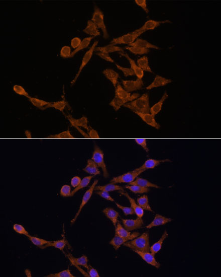UBE2J1 Polyclonal Antibody