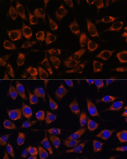 CCDC47 Polyclonal Antibody