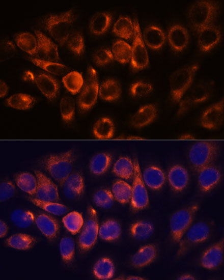 ATL2 Polyclonal Antibody
