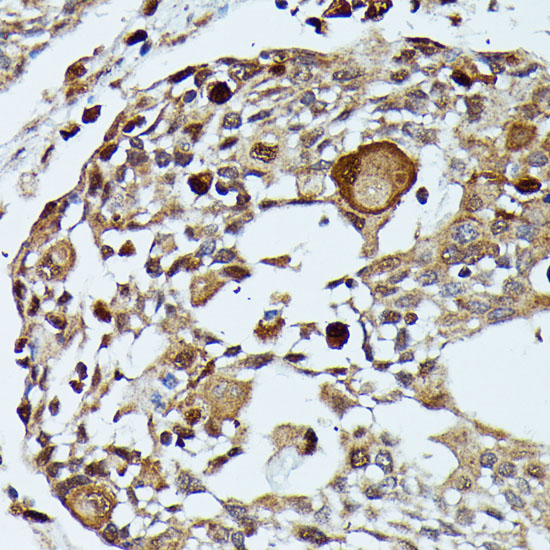 MAP3K3 Polyclonal Antibody