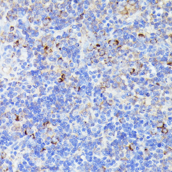 CCDC6 Polyclonal Antibody