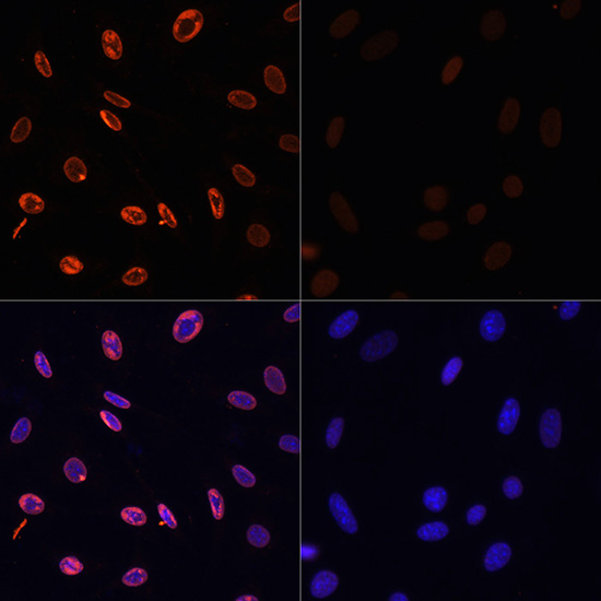 Acetyl-Histone H3-K36 pAb