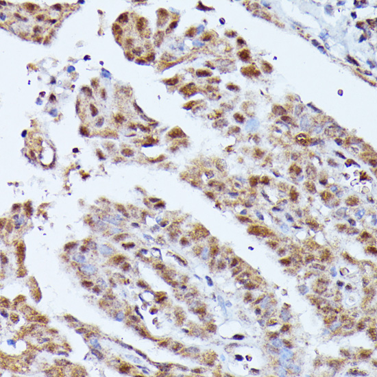 KIAA1429 Polyclonal Antibody
