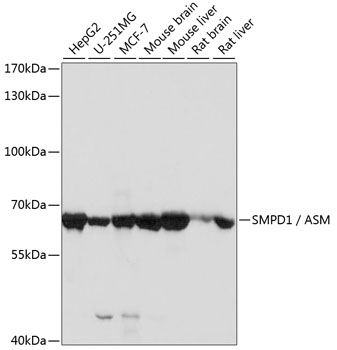 SMPD1 / ASM Polyclonal Antibody