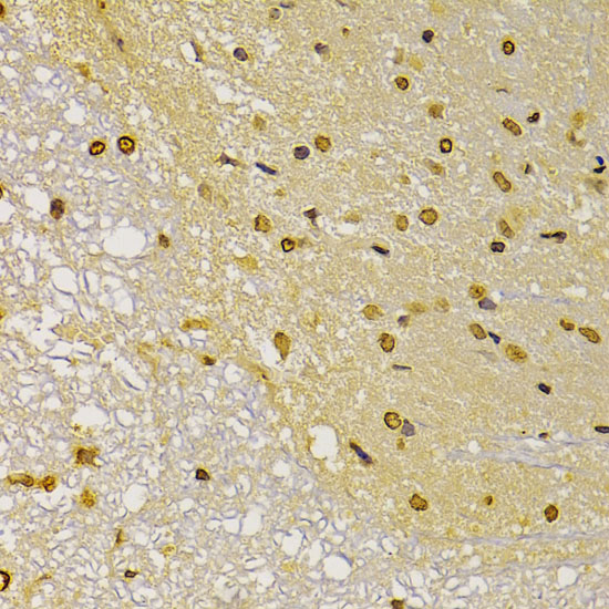 S100A4 antibody