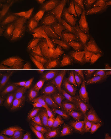 CDK6 antibody