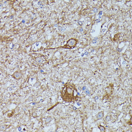 FKBP1B Polyclonal Antibody