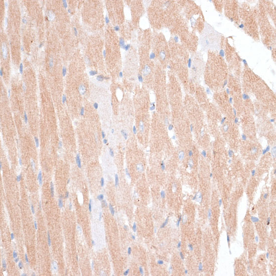 KATNA1 Polyclonal Antibody