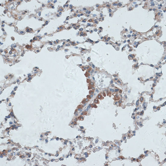 PMEPA1 Polyclonal Antibody