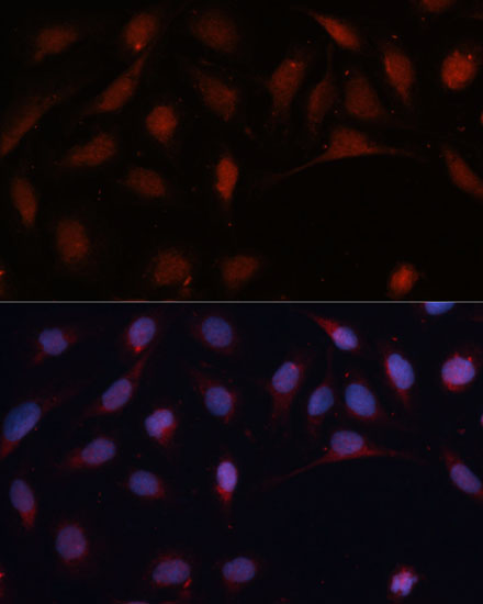 ASC / TMS1 Polyclonal Antibody