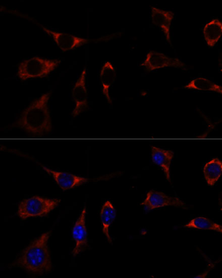 RPL26 Polyclonal Antibody