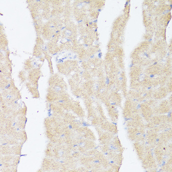 BMPR2 Polyclonal Antibody