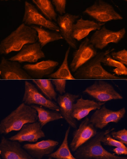 SMAD2/SMAD3 Polyclonal Antibody