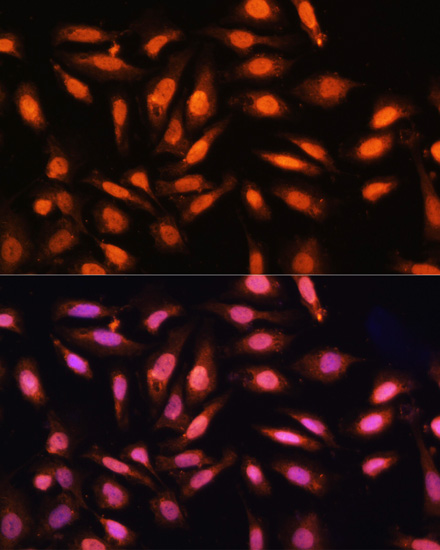 P70 S6K Polyclonal Antibody