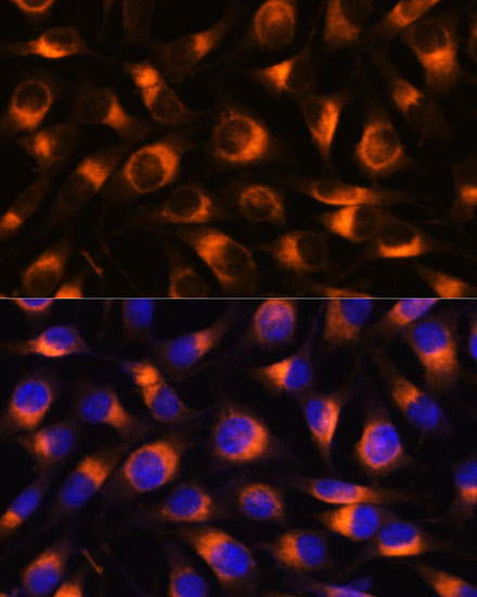 VAT1 Polyclonal Antibody