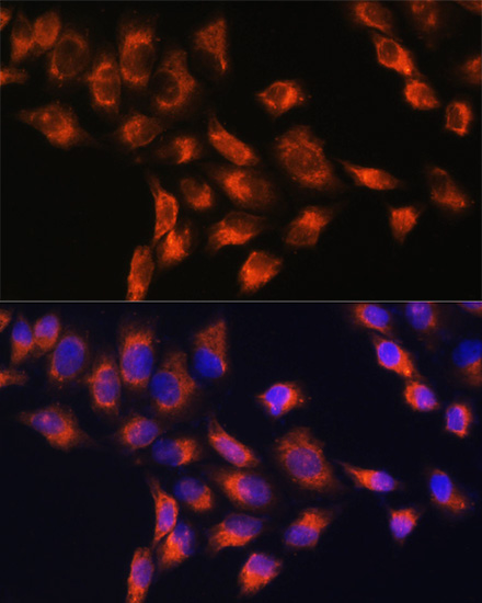 SERPING1 Antibody