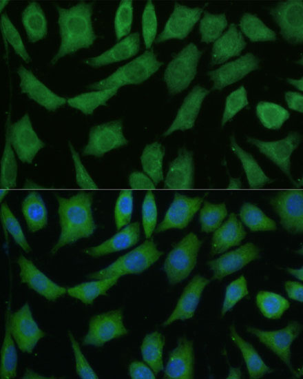 DRG2 Polyclonal Antibody