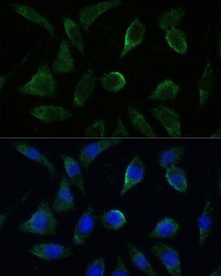 GK2 Polyclonal Antibody