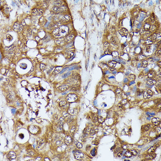 MAK Polyclonal Antibody