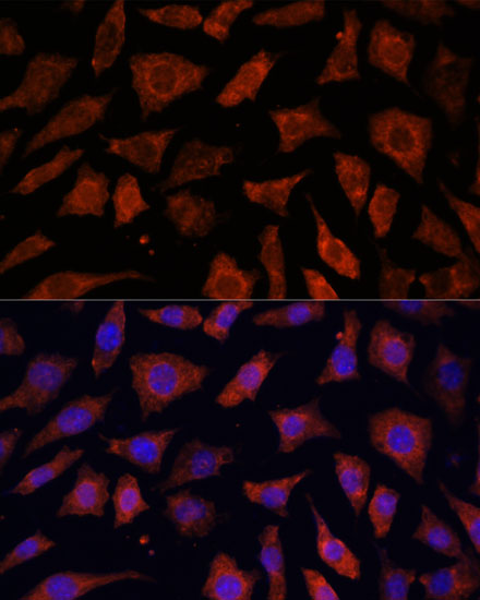 PDE6G Polyclonal Antibody