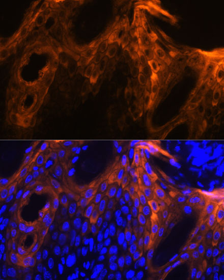 SPRR1A Polyclonal Antibody