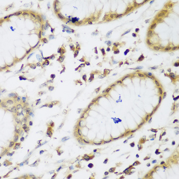 UBE3A Polyclonal Antibody