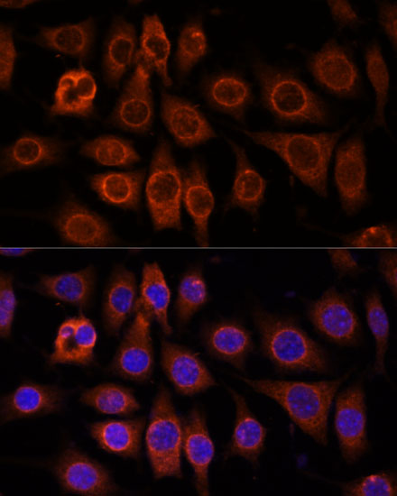 TMEM11 Polyclonal Antibody