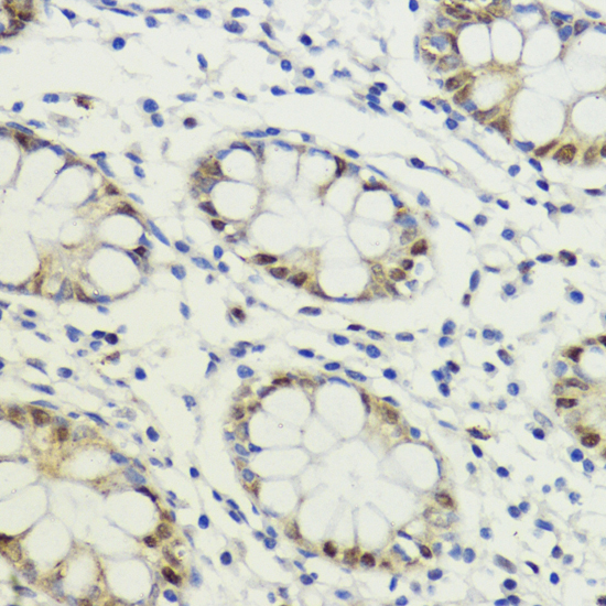 LDB1 Polyclonal Antibody