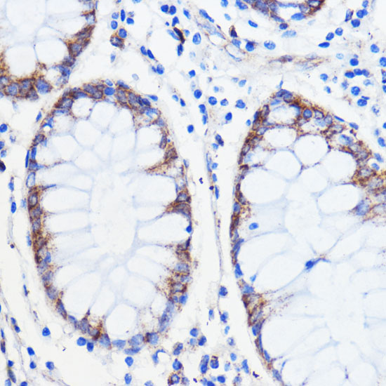 TMED3 Rabbit Polyclonal Antibody