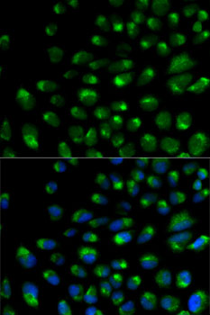 IFNAR2 Antibody