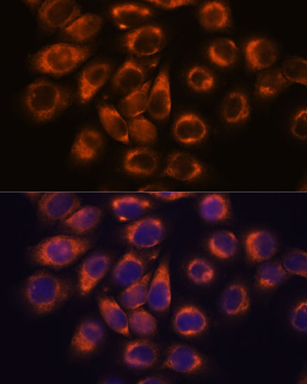 SMAP1 Polyclonal Antibody