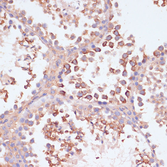 MRPL41 Rabbit Polyclonal Antibody