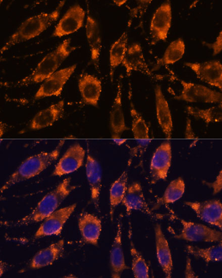 STEAP4 Rabbit Polyclonal Antibody