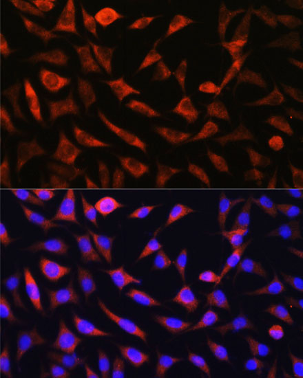 SLC25A22 Polyclonal Antibody