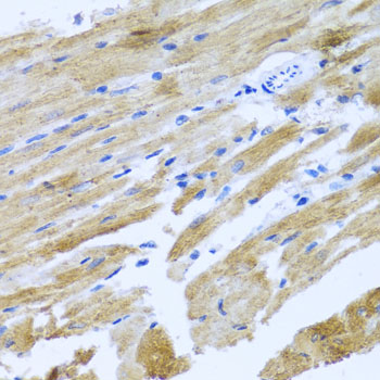 RAGE antibody