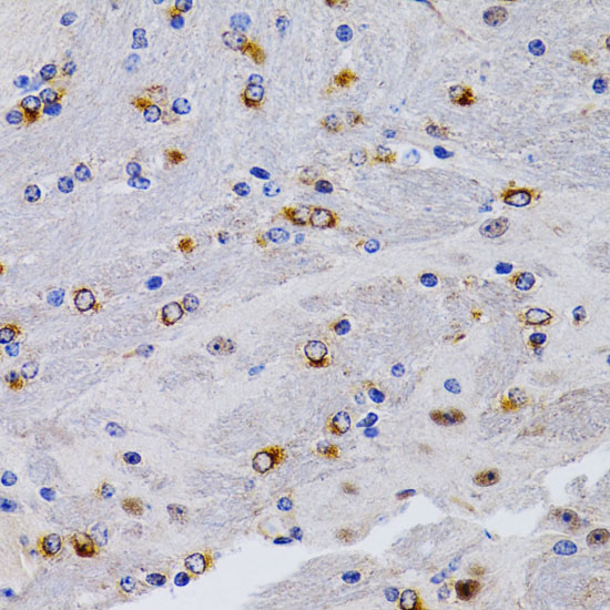 TFF1 antibody
