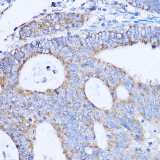 MT-ND3 Rabbit Polyclonal Antibody
