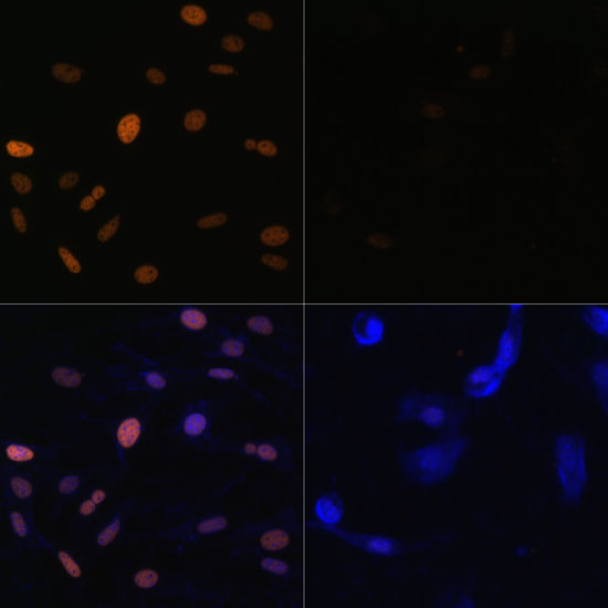 Acetyl-Histone H3-K23 pAb