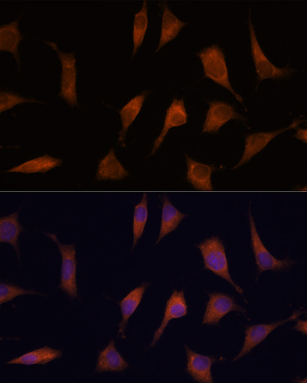 NCAPD2 Rabbit Polyclonal Antibody
