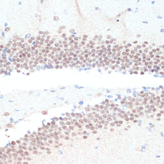 RXRG Polyclonal Antibody