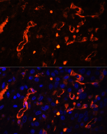 FSCN1 Polyclonal Antibody