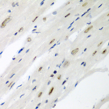 CDC27 Rabbit Polyclonal Antibody