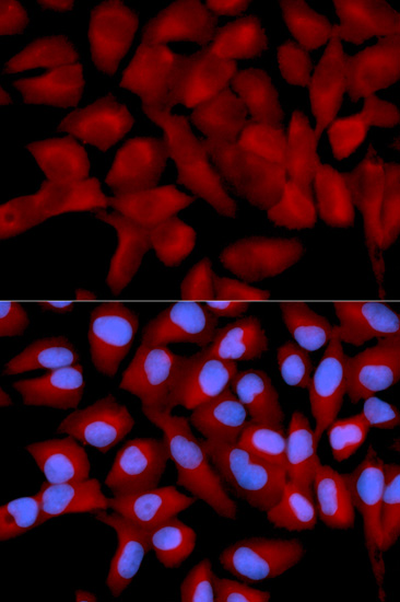 EIF5A Antibody