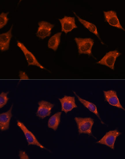 MALT1 antibody