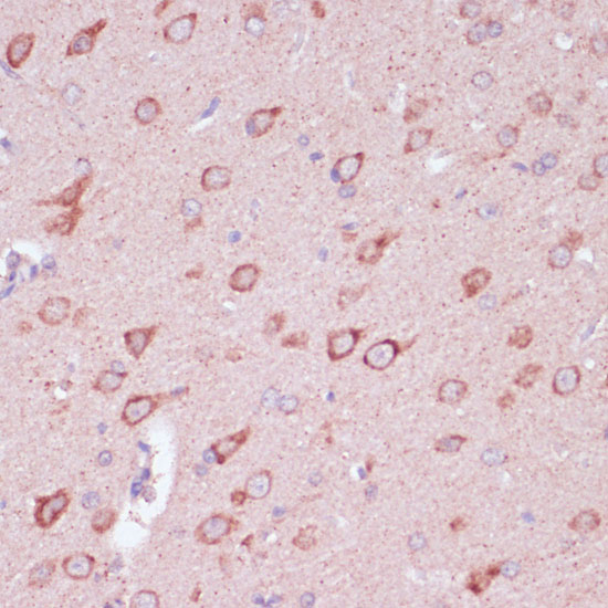TOLLIP Antibody