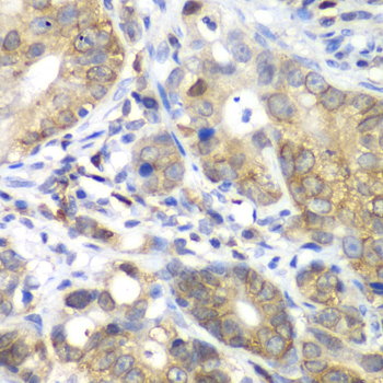 CDK1 Rabbit Polyclonal Antibody