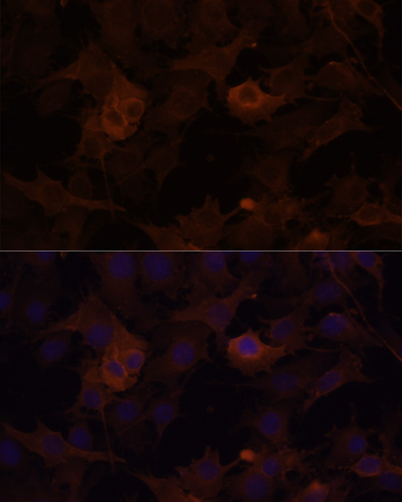FLNB Polyclonal Antibody