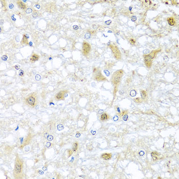 ATP2C1 Rabbit Polyclonal Antibody