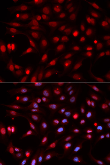 APEX1 Polyclonal Antibody