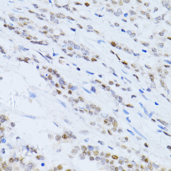 P21 Polyclonal Antibody